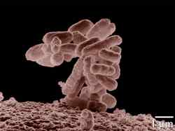 E coli