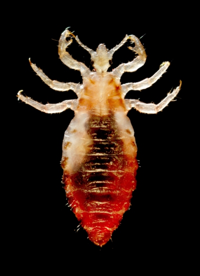 Uš Glave (Pediculus Humanus Capitis)