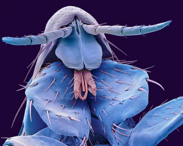 insekti Ljudska buha