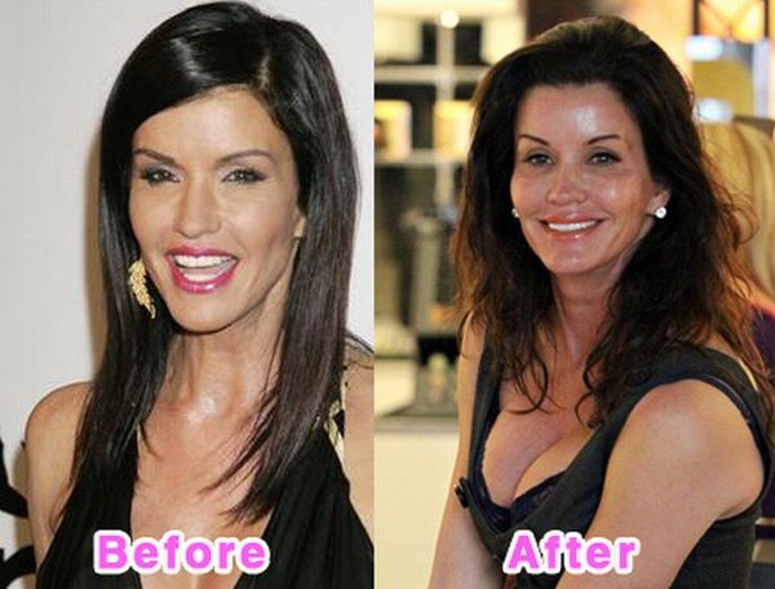 Before and After... does it work?