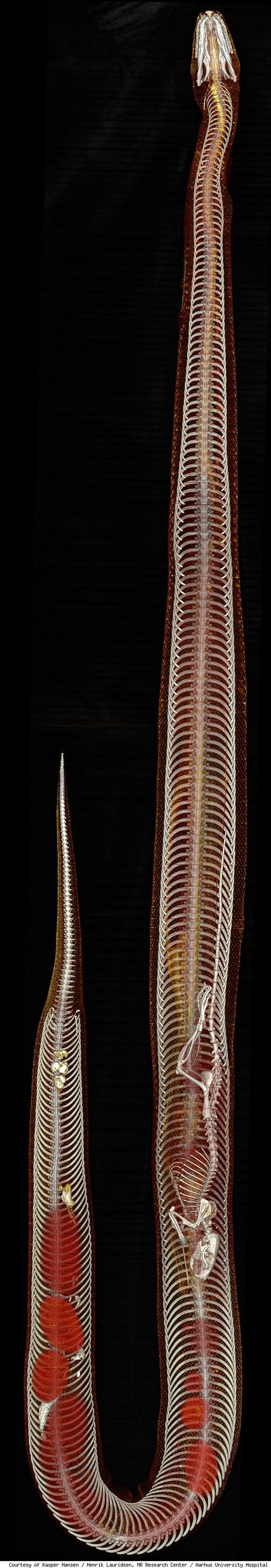 Endoskop