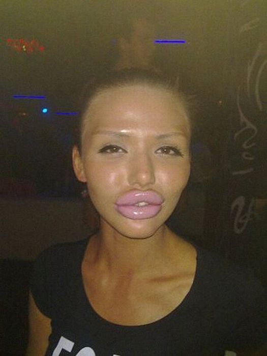 operacije Beauty or?